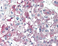 Immunohistochemistry (Formalin/PFA-fixed paraffin-embedded sections) - Anti-CARD9 antibody (AB115578)