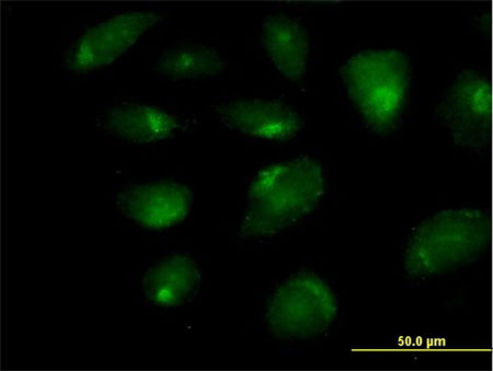 Immunocytochemistry/ Immunofluorescence - Anti-CARD9 antibody (AB169623)