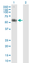 Western blot - Anti-CARD9 antibody (AB169623)