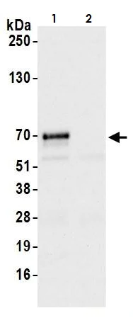 Immunoprecipitation - Anti-CARD9 antibody (AB264412)