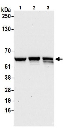 Western blot - Anti-CARD9 antibody (AB264412)