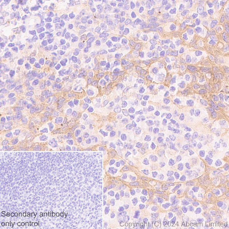 Immunohistochemistry (Formalin/PFA-fixed paraffin-embedded sections) - Anti-CARD9 antibody [EPR28960-64] (AB322105)