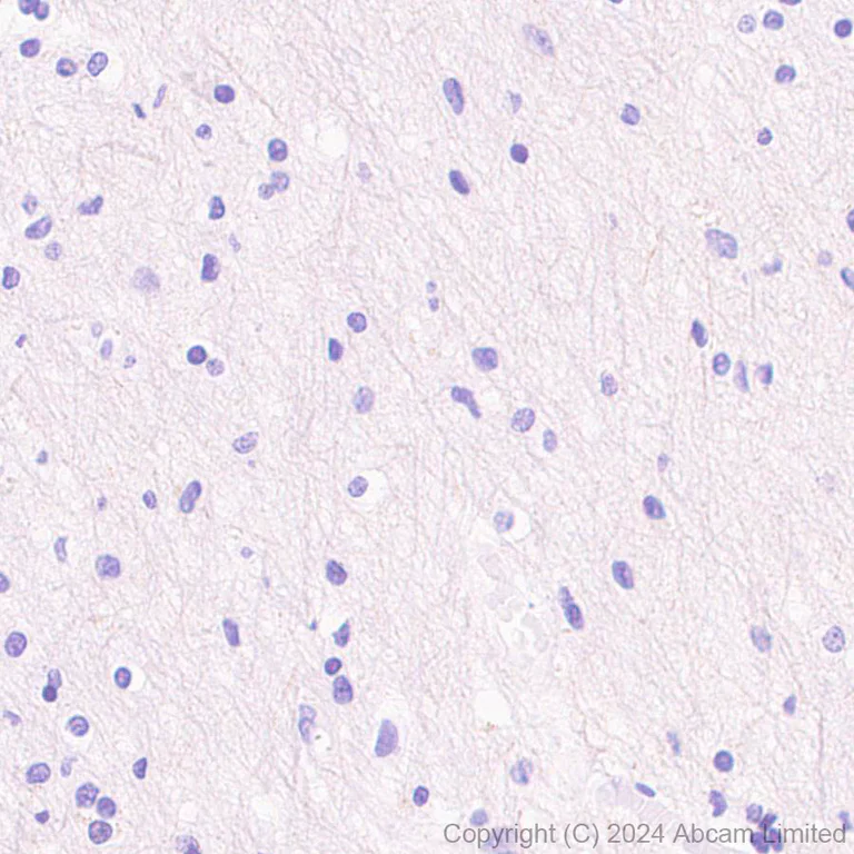 Immunohistochemistry (Formalin/PFA-fixed paraffin-embedded sections) - Anti-CARD9 antibody [EPR28960-64] (AB322105)