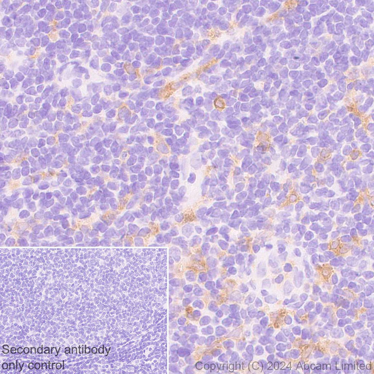 Immunohistochemistry (Formalin/PFA-fixed paraffin-embedded sections) - Anti-CARD9 antibody [EPR28960-64] - BSA and Azide free (AB324846)