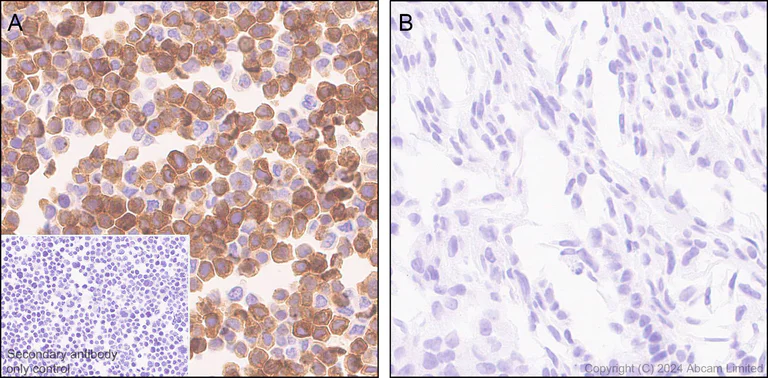 Immunohistochemistry (Formalin/PFA-fixed paraffin-embedded sections) - Anti-CARD9 antibody [EPR28960-64] - BSA and Azide free (AB324846)