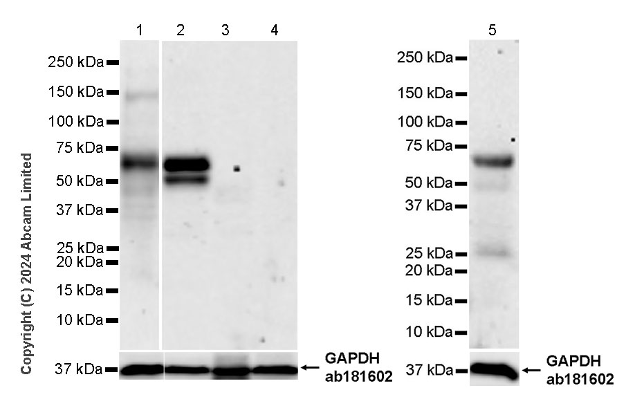 Western blot - Anti-CARD9 antibody [EPR28960-91] (AB322352), expandable thumbnail