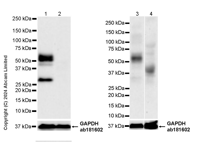 Western blot - Anti-CARD9 antibody [EPR28960-91] (AB322352), expandable thumbnail