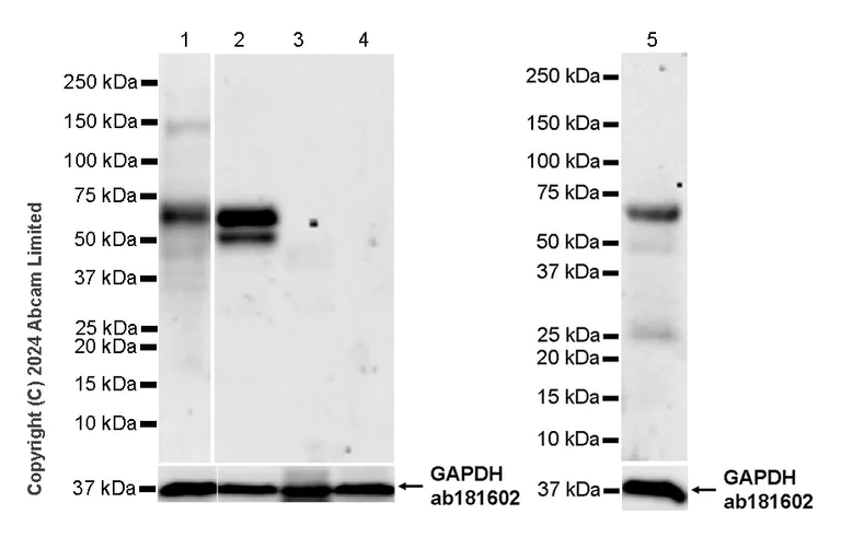 Western blot - Anti-CARD9 antibody [EPR28960-91] - BSA and Azide free (AB324792)