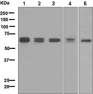 Western blot - Anti-CARD9 antibody [EPR6489] (AB133560)
