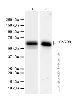 Western blot - Anti-CARD9 antibody [EPR6489] (AB133560)