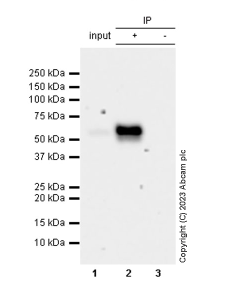 Immunoprecipitation - Anti-CARD9 antibody [EPR6489] - BSA and Azide free (AB240068)