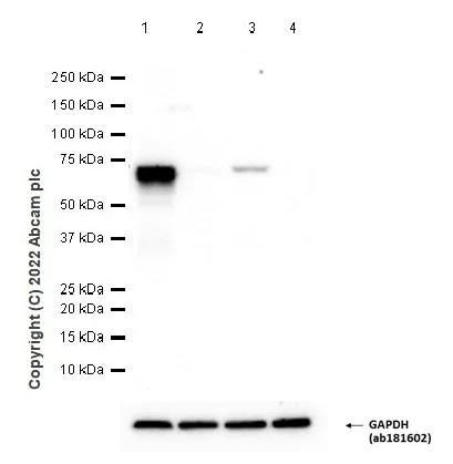 Western blot - Anti-CARD9 antibody [EPR6489] - BSA and Azide free (AB240068)