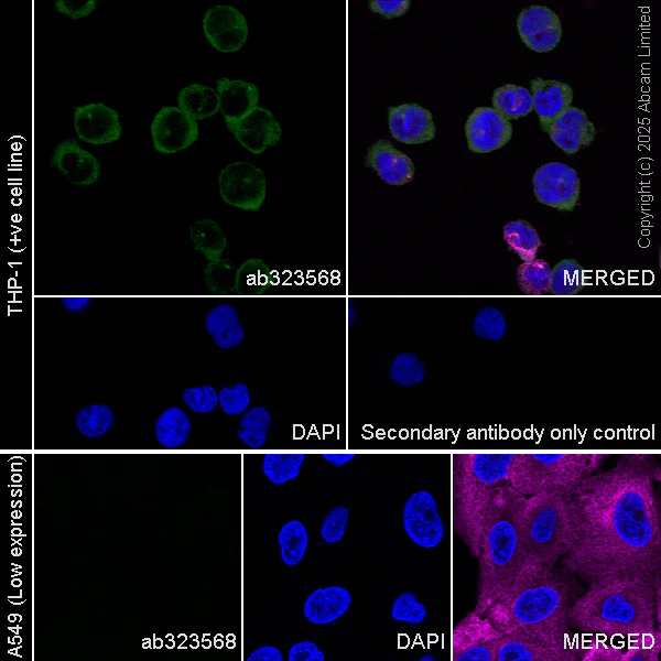 Immunocytochemistry/ Immunofluorescence - Anti-CARD9 antibody [RM2079] (AB323568)