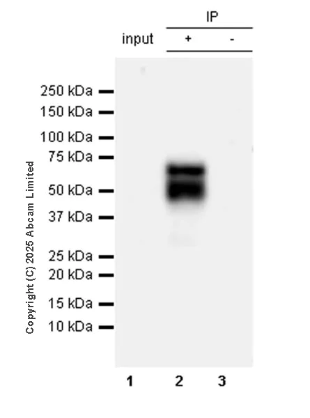 Immunoprecipitation - Anti-CARD9 antibody [RM2079] (AB323568)