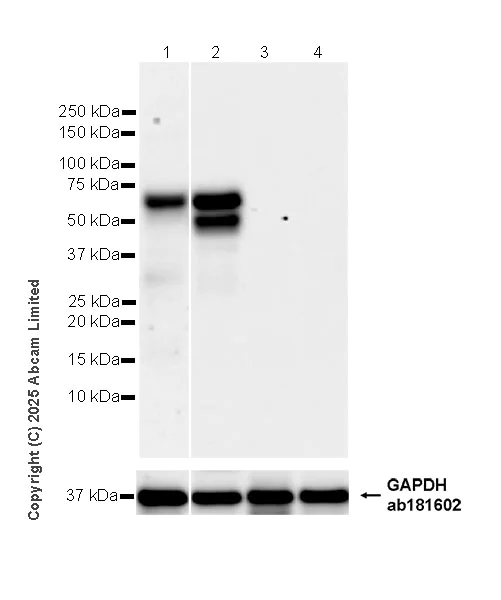 Western blot - Anti-CARD9 antibody [RM2079] (AB323568)