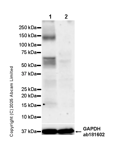 Western blot - Anti-CARD9 antibody [RM2079] (AB323568)