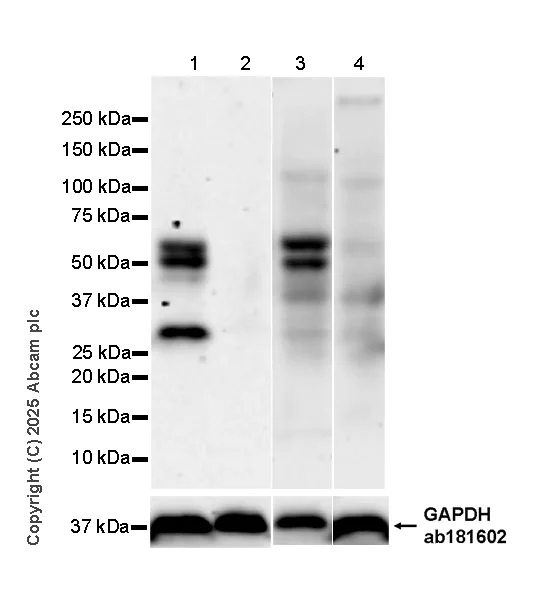 Western blot - Anti-CARD9 antibody [RM2079] (AB323568)