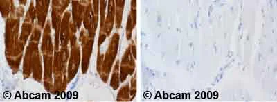Immunohistochemistry (Formalin/PFA-fixed paraffin-embedded sections) - Anti-Cardiac Troponin I antibody [4C2] (AB10231)