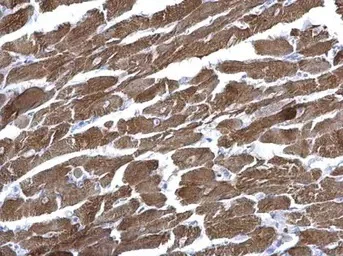 Immunohistochemistry (Formalin/PFA-fixed paraffin-embedded sections) - Anti-Cardiac Troponin I antibody (AB155047)