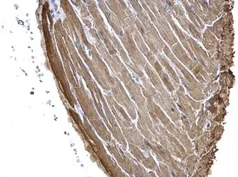 Immunohistochemistry (Formalin/PFA-fixed paraffin-embedded sections) - Anti-Cardiac Troponin I antibody (AB155047)