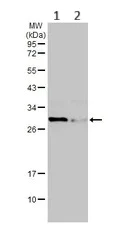 Western blot - Anti-Cardiac Troponin I antibody (AB155047)