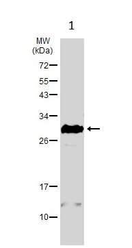 Western blot - Anti-Cardiac Troponin I antibody (AB155047)