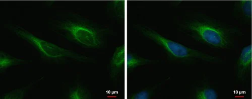 Immunocytochemistry/ Immunofluorescence - Anti-Cardiac Troponin I antibody (AB228847)