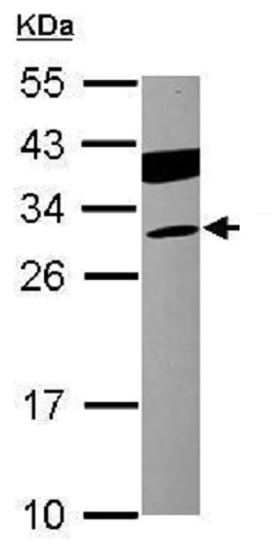 Western blot - Anti-Cardiac Troponin I antibody (AB228847)