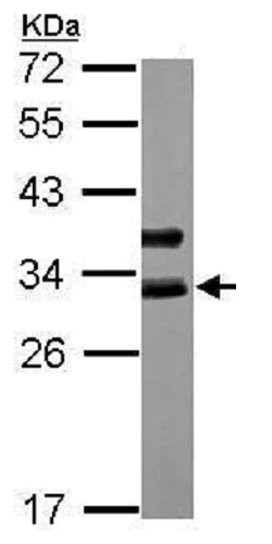 Western blot - Anti-Cardiac Troponin I antibody (AB228847)