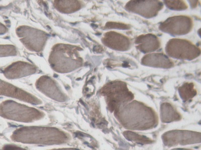 Immunohistochemistry (Formalin/PFA-fixed paraffin-embedded sections) - Anti-Cardiac Troponin I antibody (ab231064), expandable thumbnail