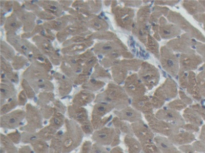 Immunohistochemistry (Formalin/PFA-fixed paraffin-embedded sections) - Anti-Cardiac Troponin I antibody (AB231064), expandable thumbnail