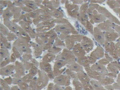 Immunohistochemistry (Formalin/PFA-fixed paraffin-embedded sections) - Anti-Cardiac Troponin I antibody (AB231064)