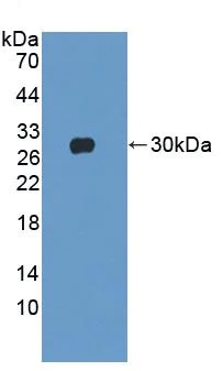 Western blot - Anti-Cardiac Troponin I antibody (AB231064)