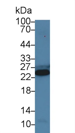 Western blot - Anti-Cardiac Troponin I antibody (AB231064)