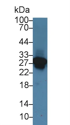 Western blot - Anti-Cardiac Troponin I antibody (AB231064)