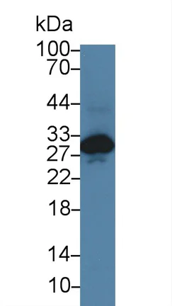 Western blot - Anti-Cardiac Troponin I antibody (AB231064)
