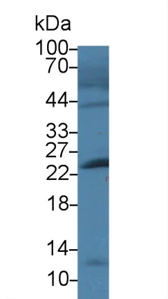 Western blot - Anti-Cardiac Troponin I antibody (AB231064)