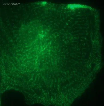 Immunocytochemistry/ Immunofluorescence - Anti-Cardiac Troponin I antibody (AB47003)
