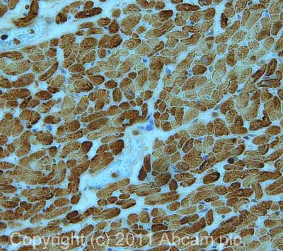 Immunohistochemistry (Formalin/PFA-fixed paraffin-embedded sections) - Anti-Cardiac Troponin I antibody (AB47003)