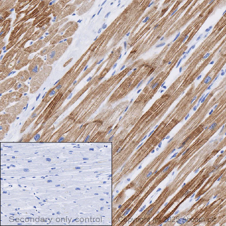Immunohistochemistry - Anti-Cardiac Troponin I antibody (AB47003)