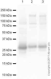 Western blot - Anti-Cardiac Troponin I antibody (AB47003)
