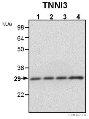 Western blot - Anti-Cardiac Troponin I antibody (AB47003)