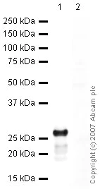 Western blot - Anti-Cardiac Troponin I antibody (AB47003)