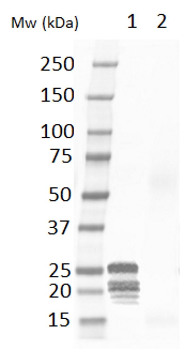 Western blot - Anti-Cardiac Troponin I antibody (AB56357)