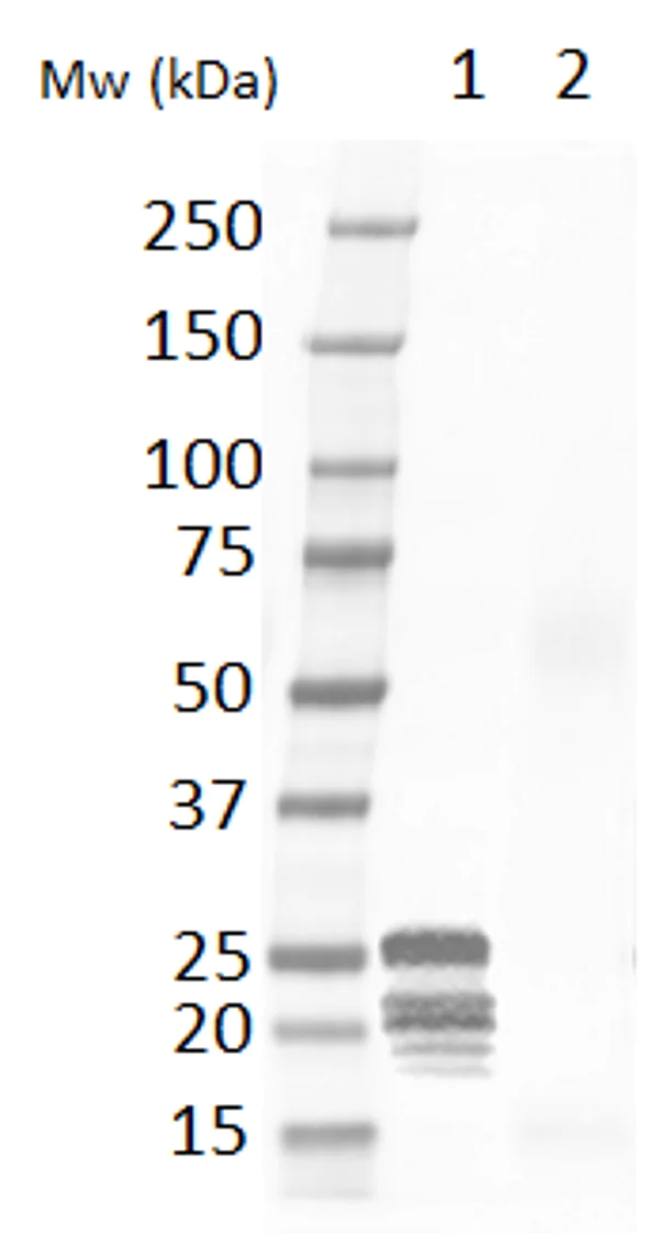 Western blot - Anti-Cardiac Troponin I antibody (AB56357)