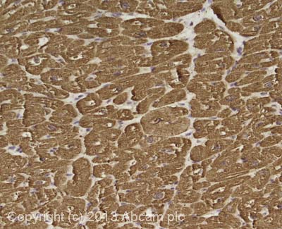 Anti-Cardiac Troponin I antibody [EP1106Y] (ab52862) | Abcam