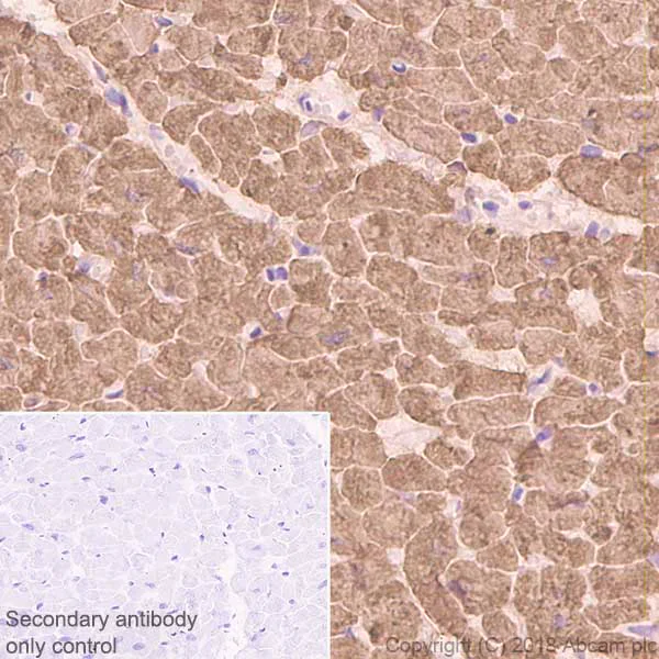 Anti-Cardiac Troponin I antibody [EP1106Y] (ab52862) | Abcam