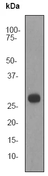 Western blot - Anti-Cardiac Troponin I antibody [EP1106Y] (AB52862)
