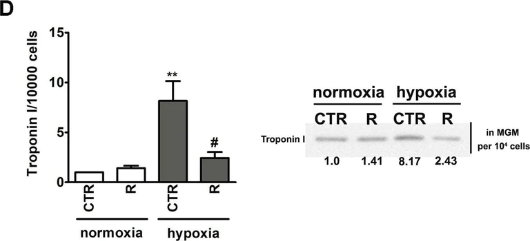 Western blot - Anti-Cardiac Troponin I antibody [EP1106Y] (AB52862)