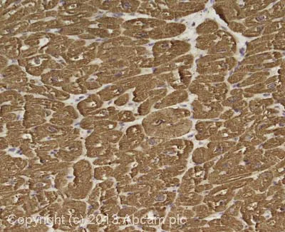 Immunohistochemistry (Formalin/PFA-fixed paraffin-embedded sections) - Anti-Cardiac Troponin I antibody [EP1106Y] - BSA and Azide free (AB182616)